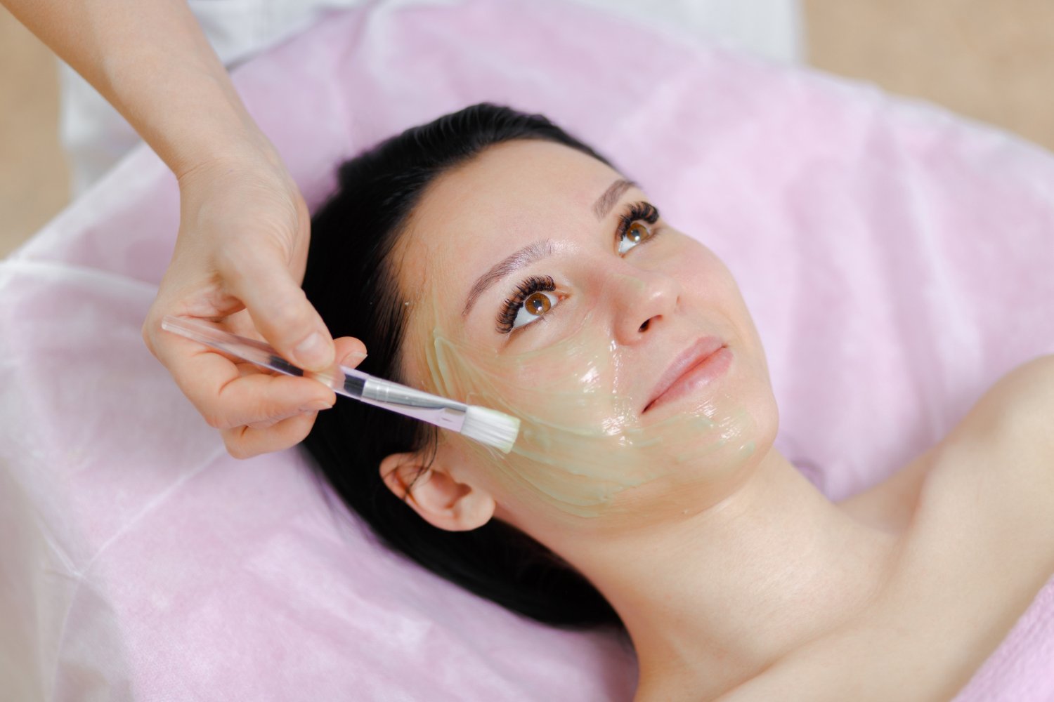 Chemical Peel Body Treatment